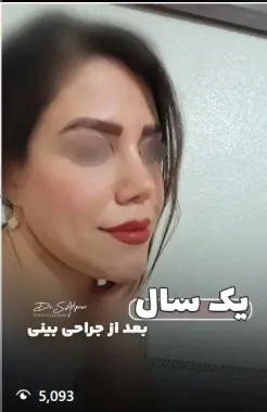 e4