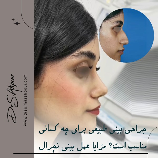 عکس بینی طبیعی عمل شده قبل و بعد