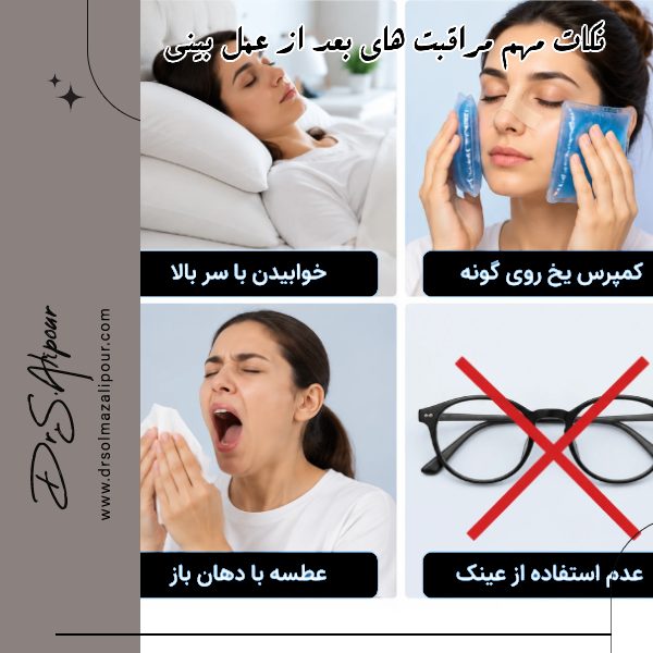 مراحل نقاهت عمل بینی + نکات مهم مراقبت های بعد از عمل بینی